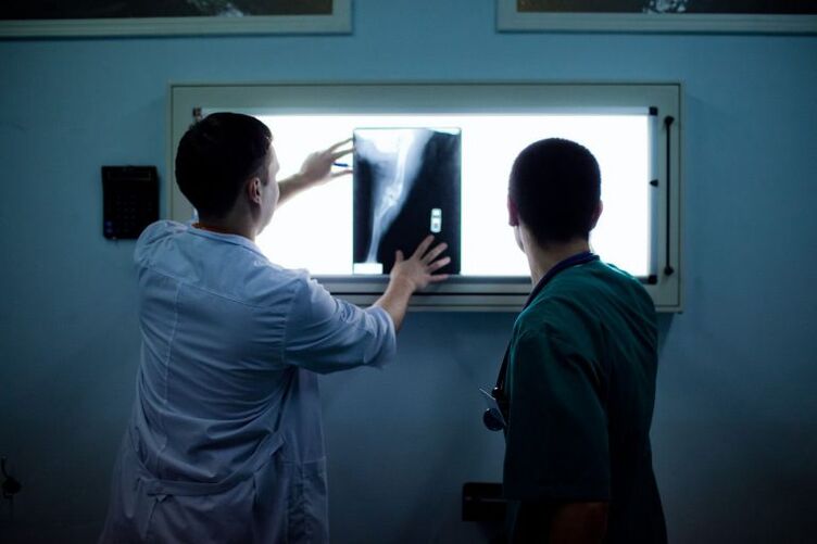 X -ray-де артрозды диагностикалау