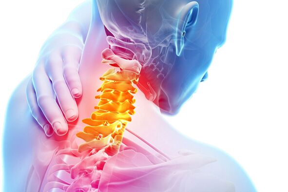 Жатыр мойны остеохондрозы